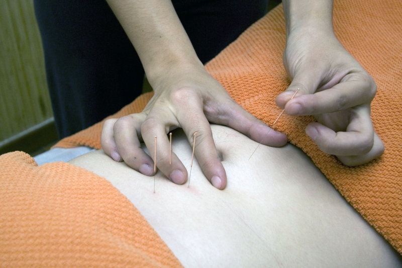 osteopathe-ROUGIERS-min_acupuncture-4175625